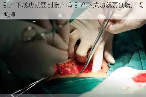 引产不成功就要剖腹产吗,引产不成功就要剖腹产吗视频