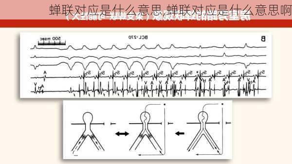 蝉联对应是什么意思,蝉联对应是什么意思啊